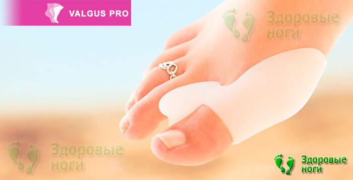 Дневной фиксатор большого пальца ноги Valgus Pro (Вальгус Про)